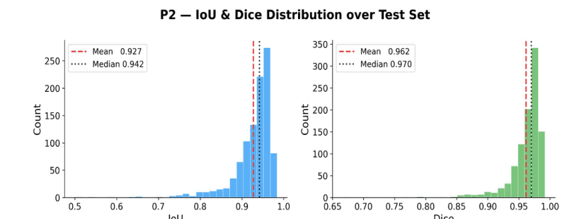Two histograms over the test set: IoU scores concentrated near 0.93 with mean 0.927 and median 0.942, and Dice scores concentrated near 0.96 with mean 0.962 and median 0.970.